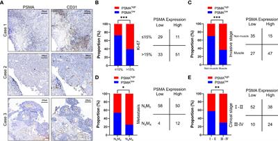 Prognostic Value of Vascular-Expressed PSMA and CD248 in Urothelial Carcinoma of the Bladder